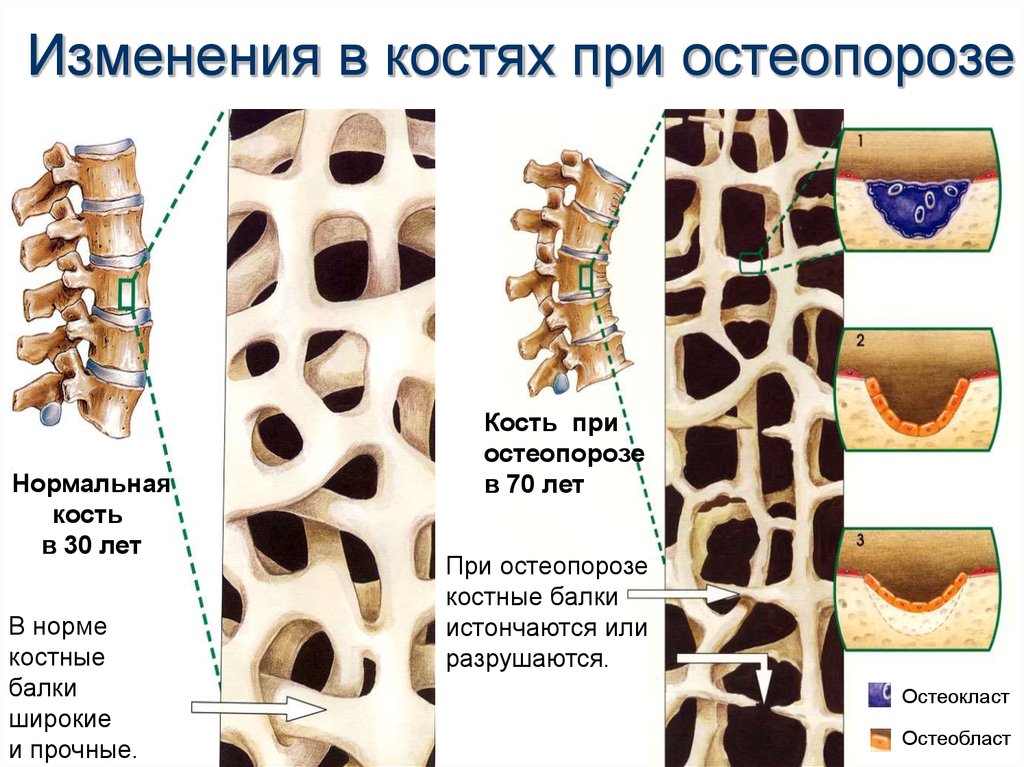 стадии развития патологии