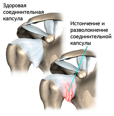 схема